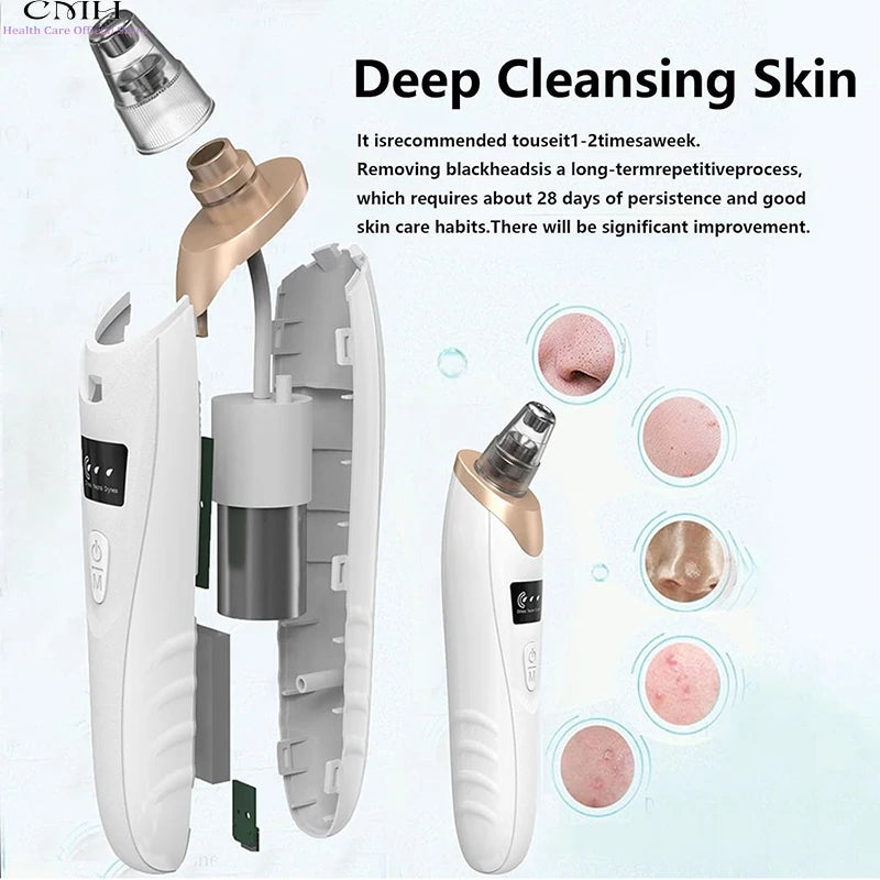 Rechargeable Blackhead Remover Vacuum