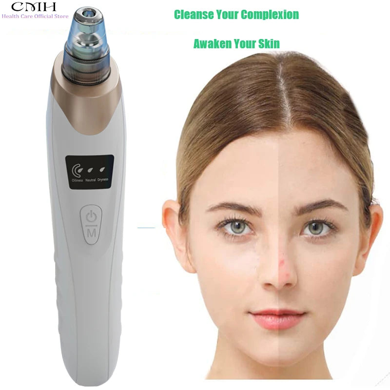 Rechargeable Blackhead Remover Vacuum